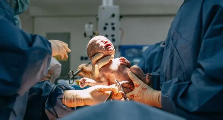 Quando a cesárea humanizada é indicada?