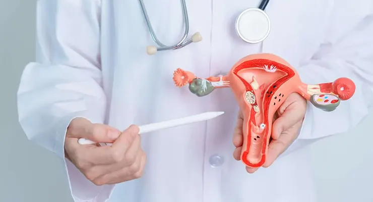 Como é feito o tratamento da SOP? Tudo o que você precisa saber para começar